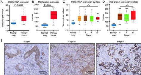 Msi Levels In Matching Pairs Of Normal Lung Tissue Versus Nsclc