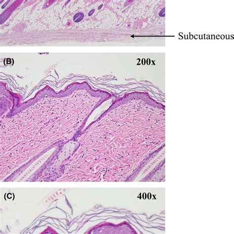 Histopathological Findings Of The Skin In Control Side A Normal Skin