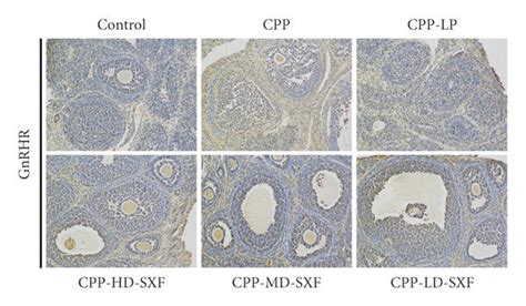 Sxf Suppressed The Expression Of Sex Hormone Receptor Related Genes In