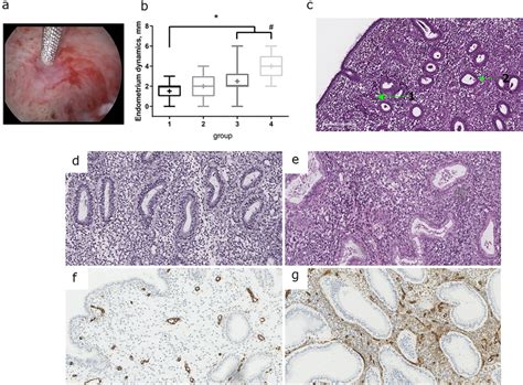 Endometrium Parameters Injection Of Autologous PRP The Image Shows