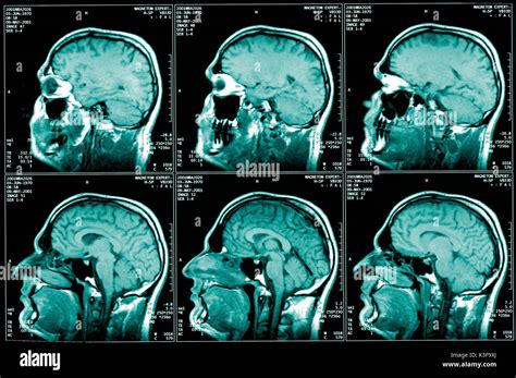 Nuclear magnetic resonance imaging hi-res stock photography and images - Alamy