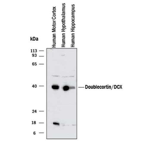 Human Mouse Doublecortin DCX Antibody R D Systems 25 μg Unconjugated