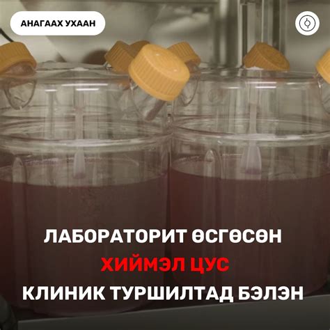Лабораторид өсгөсөн "Хиймэл цус" клиник туршилтад бэлэн - UBinfo.mn