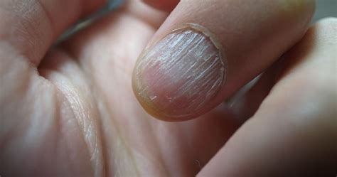 Three Ways How To Fix A Vertical Split Nail Quick Tips Dtk Nail Supply