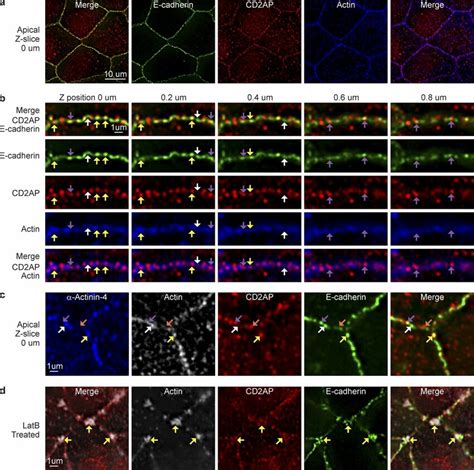 Cd2ap Localizes To Discreet Junctional Puncta In Polarized Mdck Cells