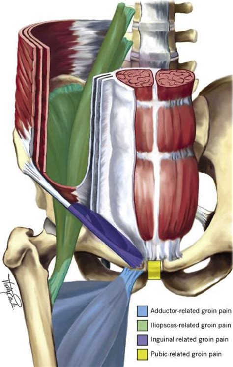 Groin Muscle Anatomy Male Evaluation Of Hernia Of The Male Inguinal