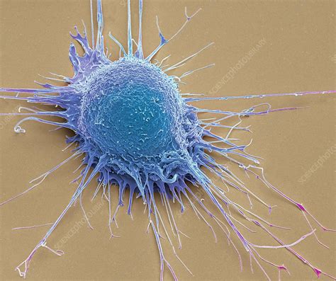 Prostate Cancer Cell Sem Stock Image C Science Photo Library