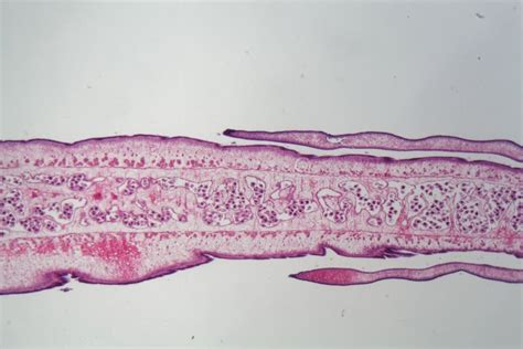 Tapeworm Under A Microscope