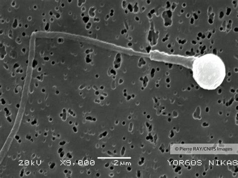 Spermatozoïde globozoocéphale observé au microscope électronique à