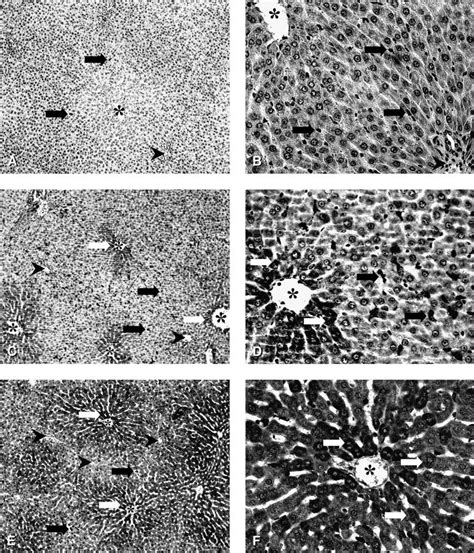 Cell Type And Spatial Expression Pattern Of HO 1 In Vehicle And