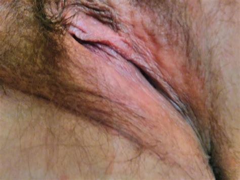 Clitoris Porn Pics Nude Women In Free Sex Photos XHamster