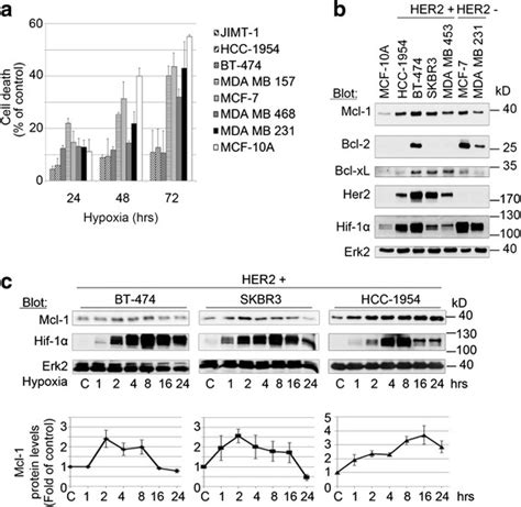 Mcl 1 Expression Correlates With Improved Adaptation Of Her2 Positive Download Scientific