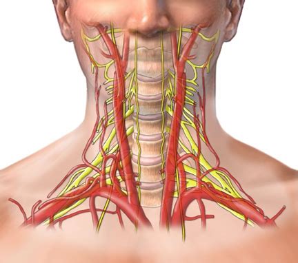 Trauma De Cuello