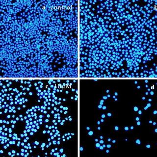 Morphological Changes Observation Of Hela Cells By Giemsa Staining