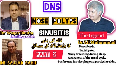 Dns Sinusitis Nose Polyps By The Legend Dr Ali Muhammad And Dr