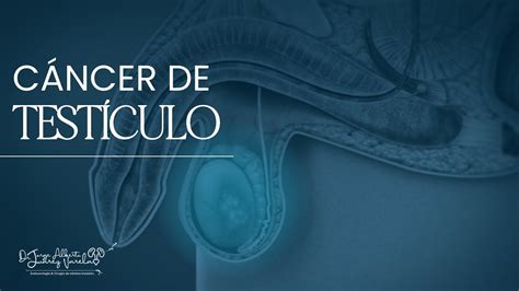 Autoexploración y Cáncer testicular YouTube