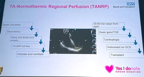 M Velia Antonini On Twitter Advances In DCD Organ Donation NRP