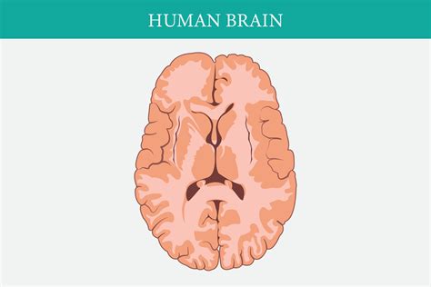 Horizontal Cross Sections Through Cerebrum Cross Section Of Human