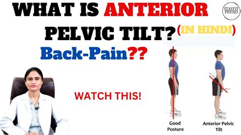 Anterior Pelvic Tilt Low Back Pain Explained In Hindi Youtube