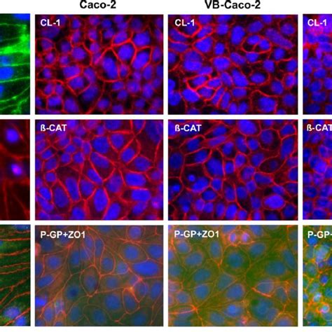 Electron Micrographs Of Rat Bbb Vb Caco 2 And Mdck Mdr1 Cell Surface