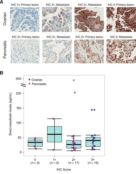 Mesothelin Staining A Representative Mesothelin Ihc Staining For