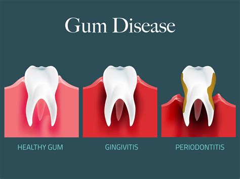 Carton Dental-Modern family dental practice in Maynooth Ireland