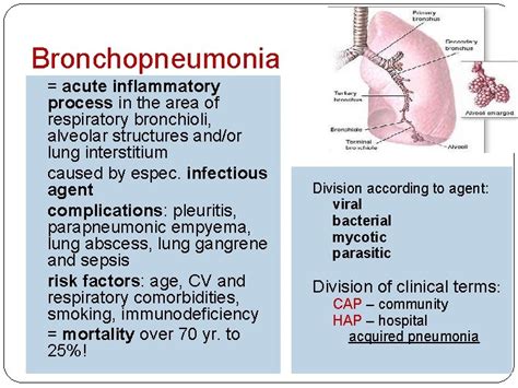 Bronchopneumonia Bronchopneumonia Acute Inflammatory Process In The Area