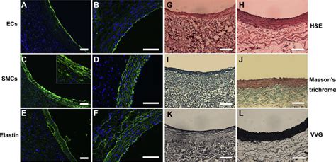 Histological Analysis And Deposition Of Extracellular Matrix In The