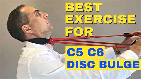 Best Exercises For C5 C6 Bulging Disc | C5 C6 Herniated Disc Exercises ...