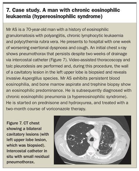 Eosinophilic Lung Diseases An Overview Respiratory Medicine Today