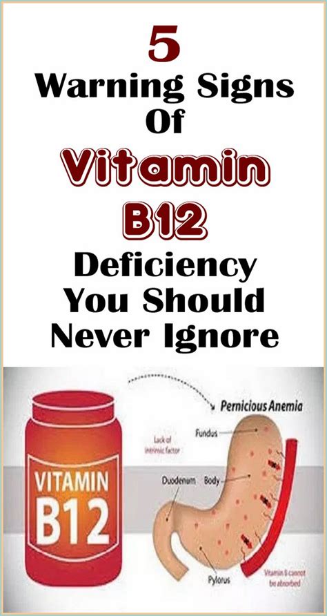 5 Warning Signs Of Vitamin B12 Deficiency You Should Never Ignore Artofit