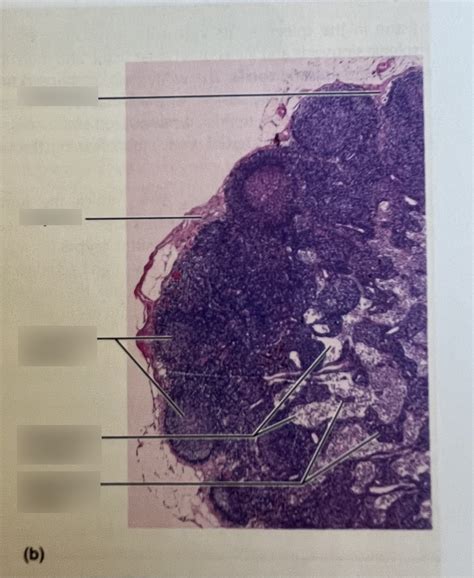 Lymph Node Histology Diagram Quizlet