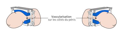 Uriclip ou Stop uri solutions mécaniques contre l incontinence urinaire