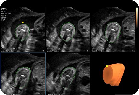 Ultrasound System V7 Samsung Healthcare Global