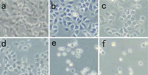 Morphological changes of HeLa cells incubated with 20 μg mL ADCPPa