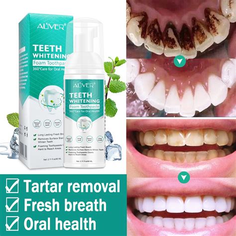 ALIVER Teeth Whitening Mousse Toothpaste Cleansing Teeth Mousse Remove