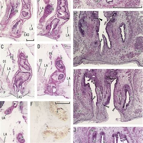 Frontal Sections Of The Anal Canal In A Fetus Of CRL Mm