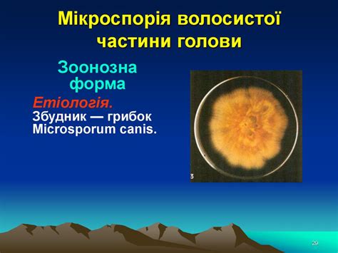 Мікози. Класифікація мікозів - презентация онлайн