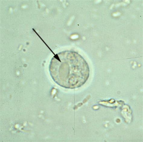 Parasite Exam Flashcards Quizlet