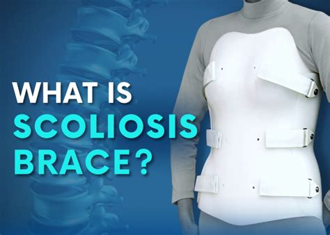 Scoliosis Braces: Can Scoliosis be Corrected with a Brace? - Turan&Turan