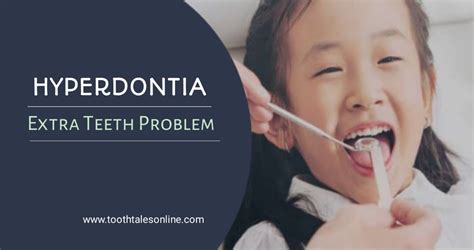 Understanding Hyperdontia The Condition Of Extra Teeth Toothtalesonline