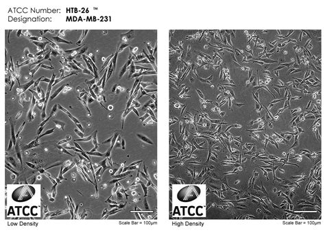 Mda Mb 231细胞atcc Htb 26细胞 Mdamb231人乳腺癌细胞株购买价格、培养基、培养条件、细胞图片、特征等基本信息生物风