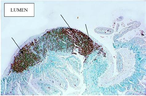 B220 Lymphocyte Localization Indicated By Arrows In Peyers Patch