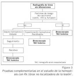 Actitud Diagn Stica Y Terap Utica Ante El Paciente Que Acude Con Hemoptisis