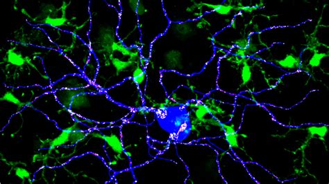 Drug Targeting Tauopathies In Mice Reveals Sex Differences In Response Ucsf Medconnection