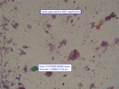 Eubacteria - 6 Kingdoms of Life