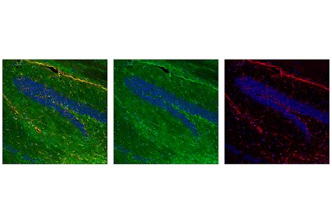 ALDH1L1 E7D7G Rabbit MAb 34391 Datasheet With Images Cell