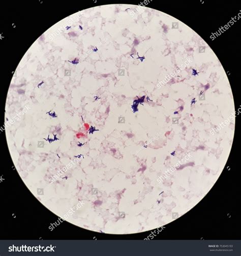 Smear Human Blood Culture Grams Stained Stock Photo