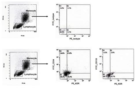 Jcm Free Full Text Adjunctive Cilostazol To Dual Antiplatelet