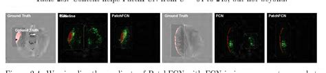 PDF Expert Level Detection Of Acute Intracranial Hemorrhage On Head